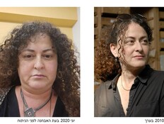 סבלה מכאבי תופת, והרופאים גילו את הסיבה רק אחרי 20 שנה