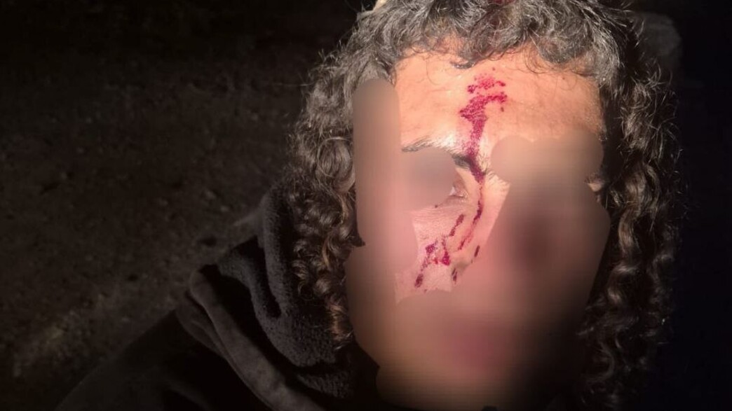 עימותים בין פלסטינים לישראלים סמוך לעלמון