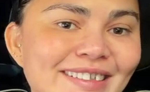 כריסי טיגן איבדה את השן הקדמית (צילום: instagram)