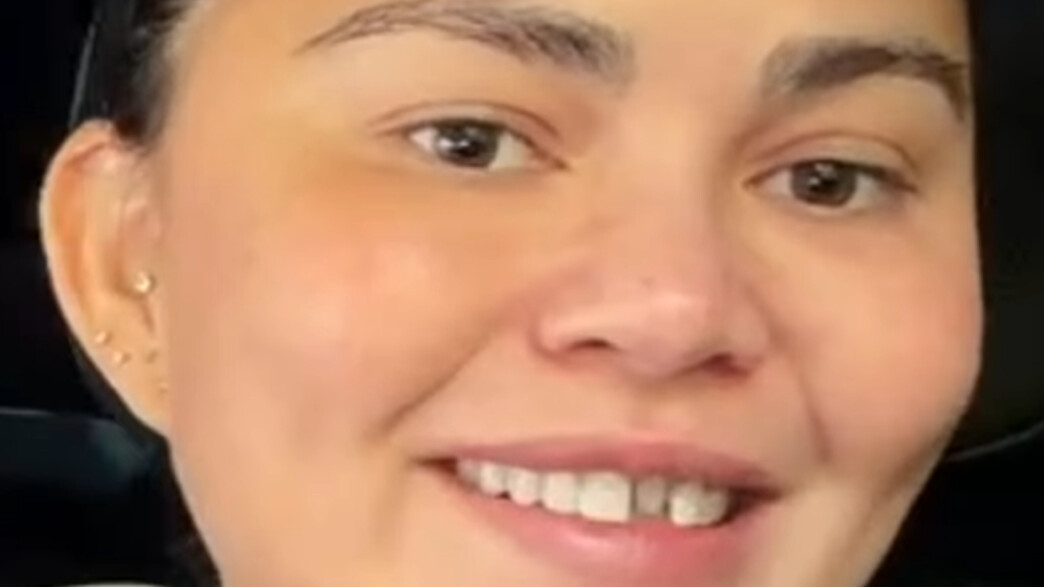 כריסי טיגן איבדה את השן הקדמית