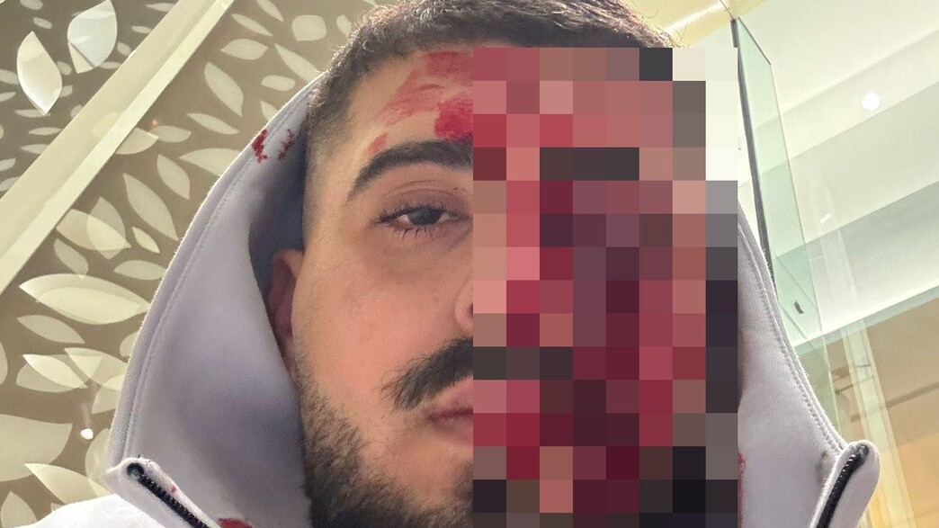 ישראלי הותקף בקפריסין ישראלי הותקף בקפריסין