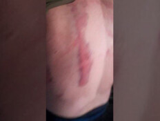 הסימנים על גופו של הצעיר מעידים: הוא כמעט נרצח