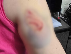 הותקפה באכזריות באמצע הרחוב: "כמעט קיבלתי דום לב"