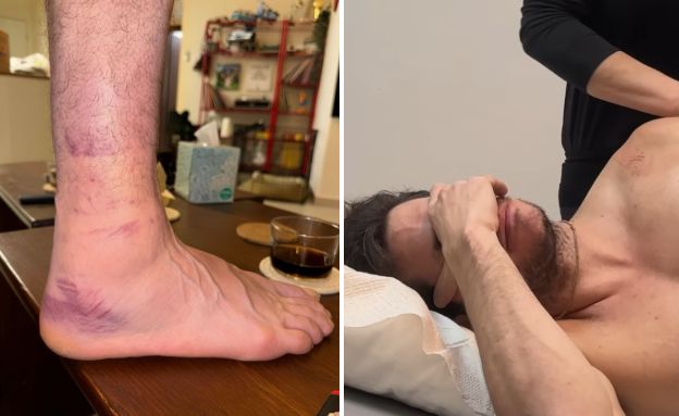 השחקן נפצע (צילום: אינסטגרם)