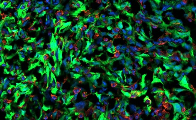 תאי סרטן מתקשרים עם תאים אסטרוציטיים במוח