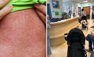 חצבת בטיפות חלב (צילום: יונתן דושניצקי + שאטרסטוק)