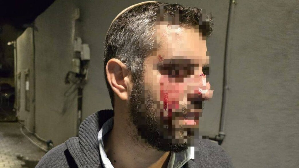 רב הותקף ביפו ופונה לביה"ח