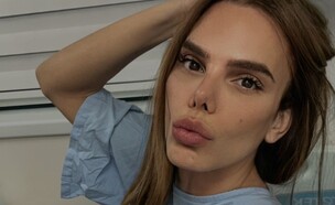 "תגידו שלום לחברים שיצאו ממני": הניתוח שעברה בל אגם (צילום: אינסטגרם)
