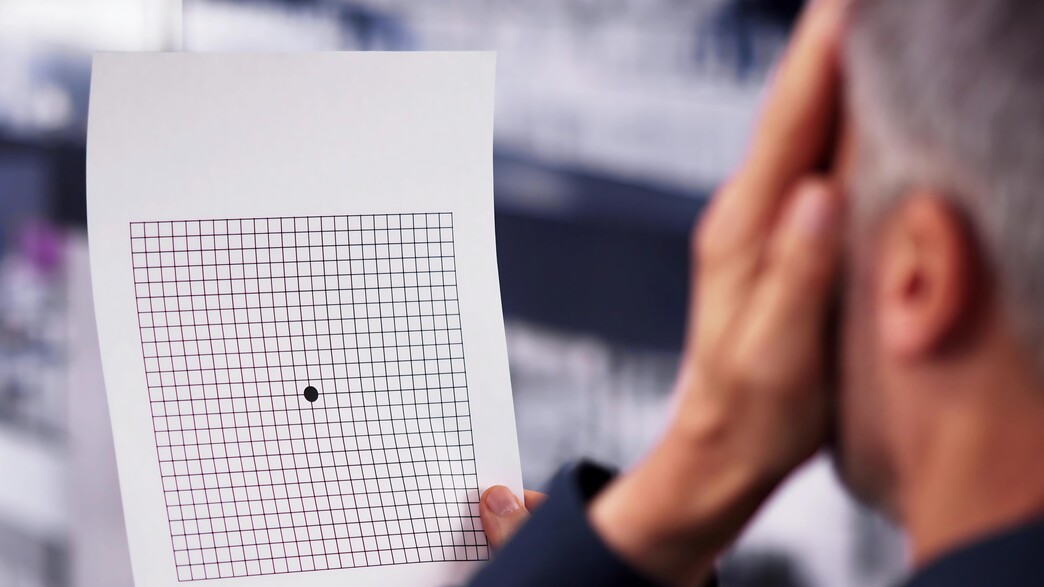 ניוון מקולרי