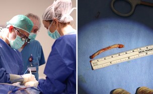 תסמונת נדירה ברמבם (צילום: רמב"ם)