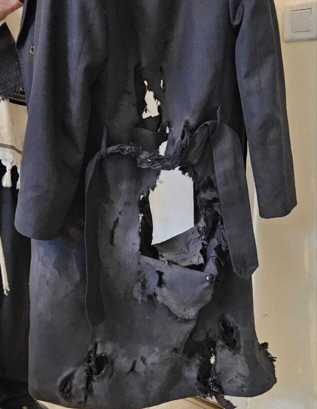 בגדיו של הנער החרדי שניצל מדריסת האוטובוס בגדיו של הנער החרדי שניצל מדריסת האוטובוס