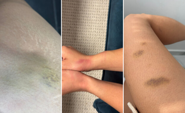 שטפי הדם בגופה של הללי אלוש, 4 ימים אחרי המעצר האל