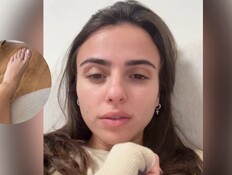 קים אור אזולאי נפילה