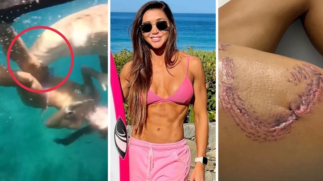 טיאנה דלאזן