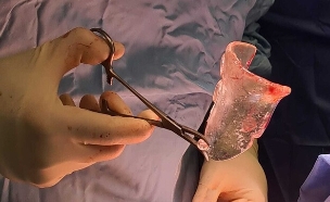 ניתוחים מתוכננים בתלת ממד (צילום: באדיבות המרכז הרפואי שיבא)