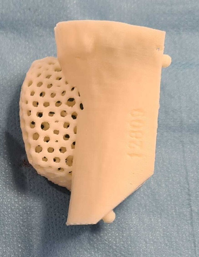 ניתוחים מתוכננים בתלת ממד