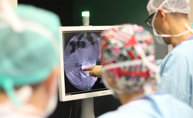 גידול נדיר וניתוח ראשון מסוגו