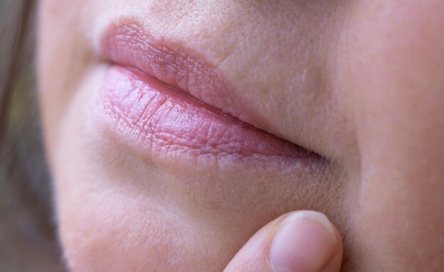 קמטים סביב השפתיים 