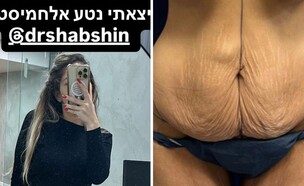 חן עשור (צילום: אינסטגרם – lihisunshine)