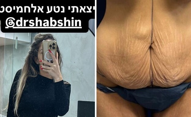 חן עשור (צילום: אינסטגרם – lihisunshine)
