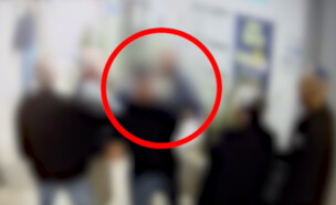 תקיפת ראש עיריית יהוד (צילום: דוברות המשטרה)