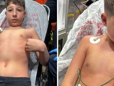 התקף האלרגיה