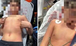 התקף האלרגיה (צילום: פרטי, שאטרסטוק)