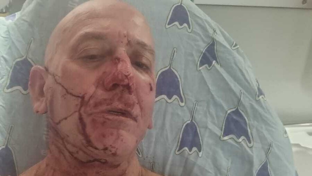 רעי צייזלר לאחר התקיפה רעי צייזלר לאחר התקיפה