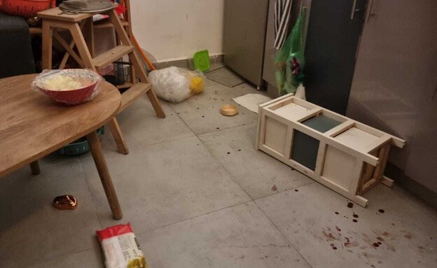 רעי צייזלר לאחר התקיפה רעי צייזלר לאחר התקיפה