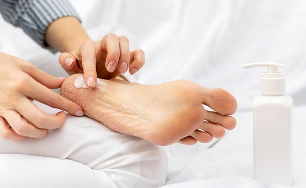 כפות רגליים סדוקות, יבשות כפות רגליים סדוקות, יבשות