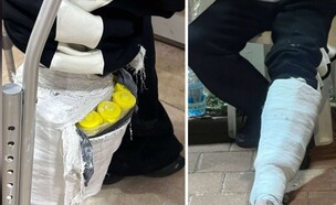 האוהד שהגיע עם גבס לאצטדיון - והסליק שהתגלה  (צילום: דוברות המשטרה)