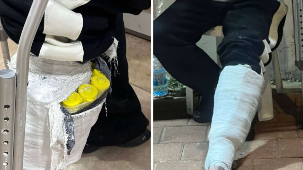 האוהד שהגיע עם גבס לאצטדיון - והסליק שהתגלה 