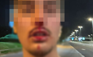 הנער שהותקף