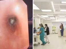 שאף בוטנים (צילום: הדסה, העמק) שאף בוטנים (צילום: הדסה, העמק)