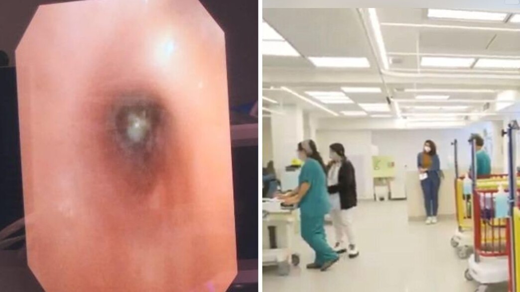 שאף בוטנים שאף בוטנים