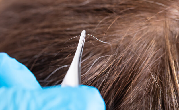 שערה לבנה (צילום: 123rf)