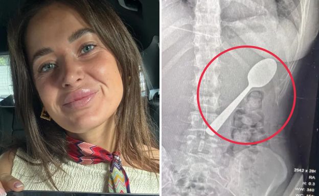 ריימי אמלינקס