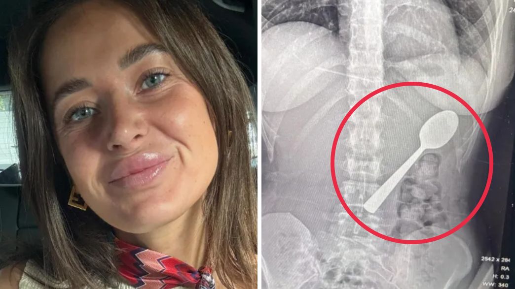 ריימי אמלינקס