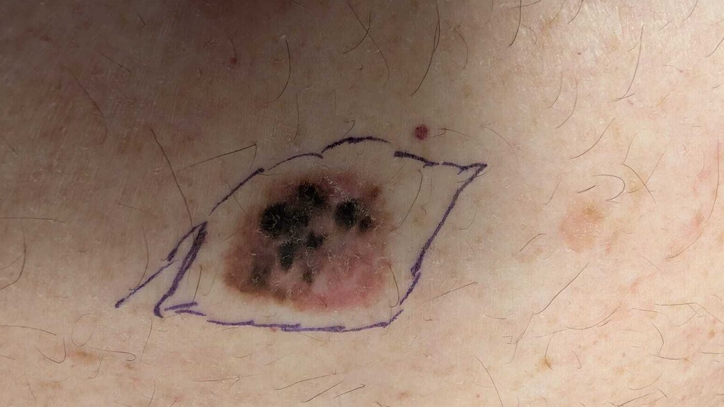 הנקודה החשודה