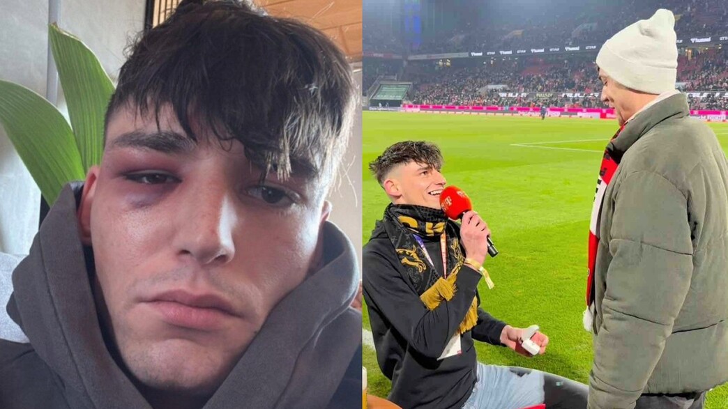 פסקל קייזר בהצעה ולאחר התקיפה