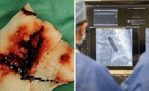 המום הנדיר (צילום: אסף הרופא)