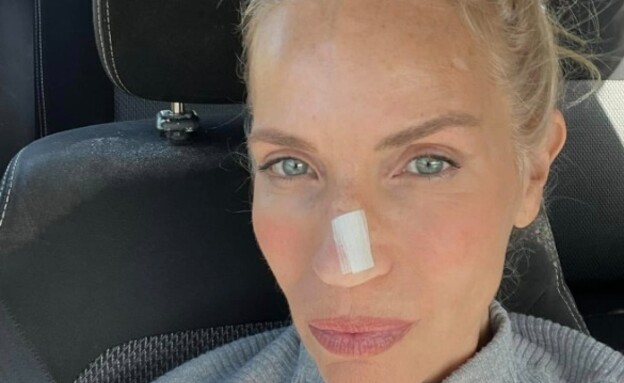 שרון פרי הורידה גידול