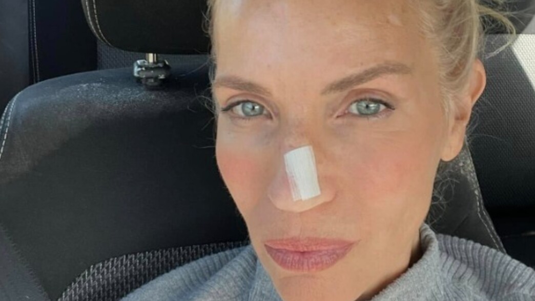 שרון פרי הורידה גידול