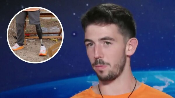 עמרי רוזנבליט והרגל התותבת עמרי רוזנבליט והרגל התותבת