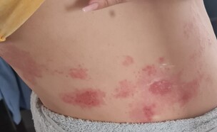 שלבקת (צילום: פרטי)