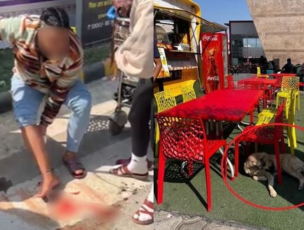 תיירת ישראלית ננשכה מחוץ לשדה תעופה בהודו - והובהלה לקבלת טיפול רפואי