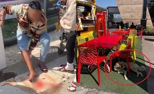 תיירת ישראלית ננשכה (צילום: ללא)