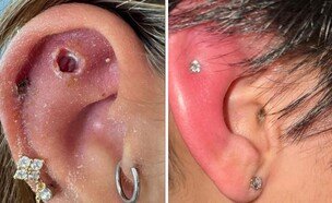 נזקי הפירסינג (צילום: פרטי)