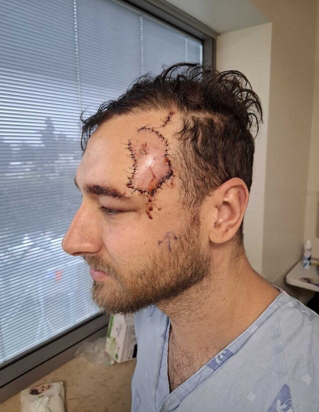 סתיו אשכנזי פצוע לאחר התקיפה