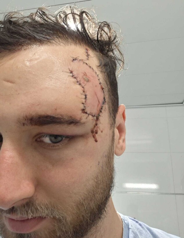 סתיו אשכנזי פצוע לאחר התקיפה